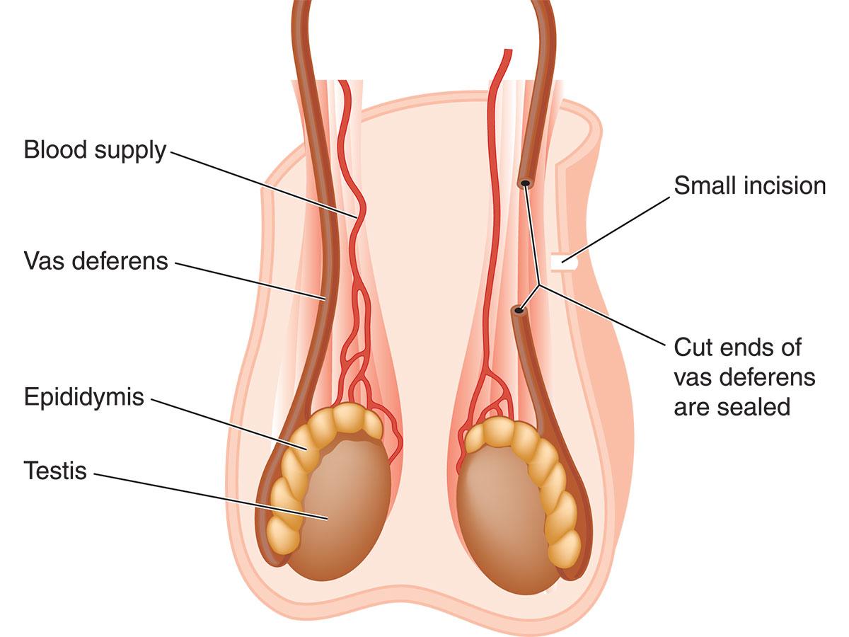 Urology Surgery